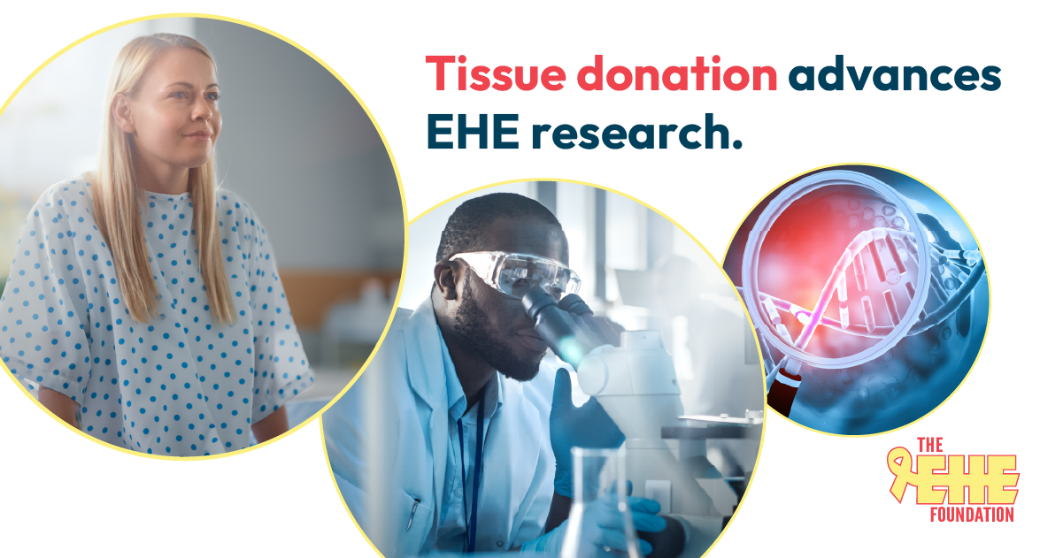 EHE-biobank-advance-research-1200 Tissue donation through the EHE Biobank